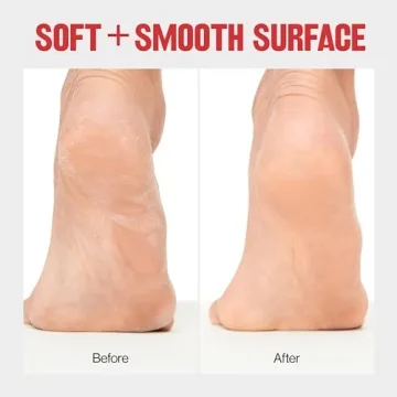 Revlon Callus Remover for Smooth Feet Anytime