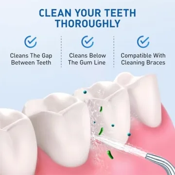 Water Flosser Replacement Tips - 6 Classic Jet Tips