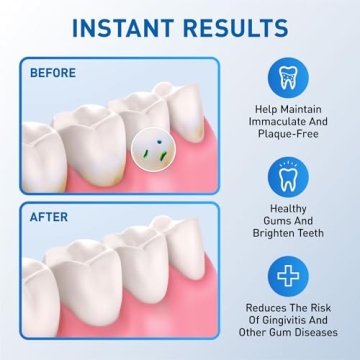 Water Flosser Replacement Tips - 6 Classic Jet Tips