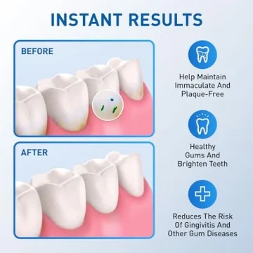 Water Flosser Replacement Tips - 6 Classic Jet Tips