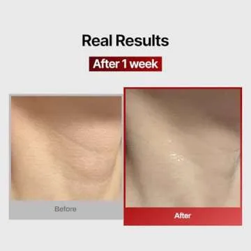 Wrinkle-fit Neck Mask for Firming and Hydrating