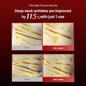 Wrinkle-fit Neck Mask for Firming and Hydrating