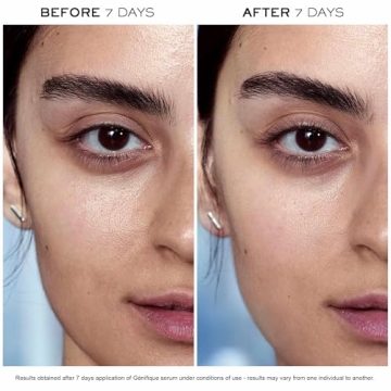 Lancôme Advanced Génifique Anti-Aging Serum for Radiance