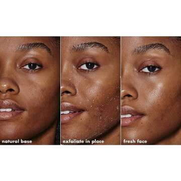 e.l.f. SKIN Gentle Peeling Exfoliant, Cleanser, Effective, Easy to Apply, Peels Away Dead Skin, Removes Dirt, Ideal for All Skin Types