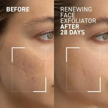 Dr. Brandt Microdermabrasion Exfoliator for Radiant Skin
