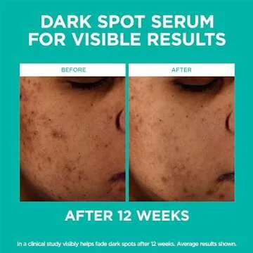 L'Oreal Niacinamide Dark Spot Duo and SPF 50 Lotion