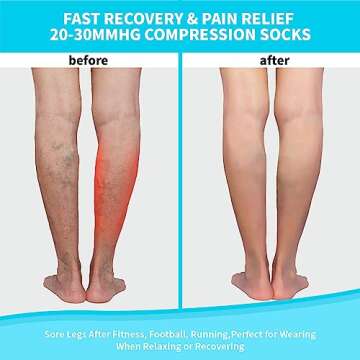 Open Toe Compression Socks 15-20 mmHg for Women and Men Knee High Toeless Circulation Compression Stockings(BN S/M)