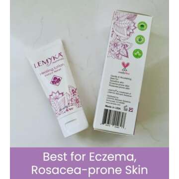 Rosacea cream -face redness relief facial rash lotion for eczema, psoriasis, hives, and dry skin, LEMYKA natural healing for babies and adults