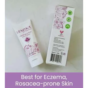 Rosacea cream -face redness relief facial rash lotion for eczema, psoriasis, hives, and dry skin, LEMYKA natural healing for babies and adults