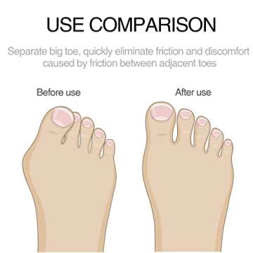 4Pairs Gel Hammer Toe Cushions for Pain Relief and Comfort