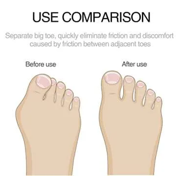 4Pairs Gel Hammer Toe Cushions for Pain Relief and Comfort