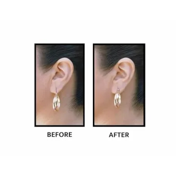 Lobe Wonder Ear Lobe Support Patches for Perfect Earrings