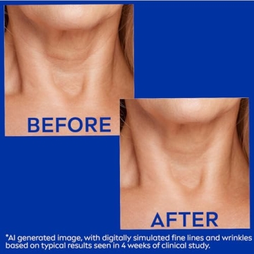 NIVEA Anti Wrinkle Neck and Chest Cream with Q10 for Youthful Skin