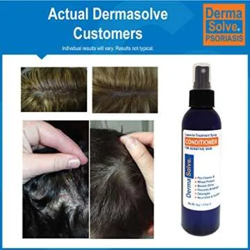 Dermasolve Psoriasis Leave-In-Treatment and Styling Spray Conditioner for Seborrheic Dermatitis, Sensitive Skin, Detangle, De-Flake, Soothing Anti Dandruff, Dry Scalp Repair for Damaged Hair