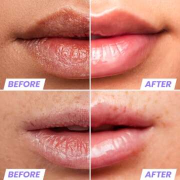 Wonderskin Lip Oil - Lip Rehab Serum Oil, Hydrating and Moisturizing Clear Serum for Dry Lips - Natu...