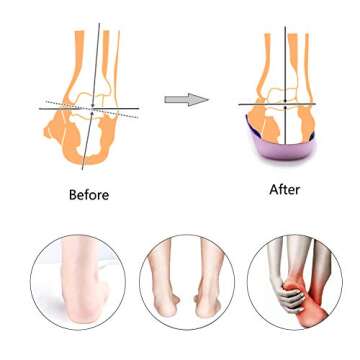 PCSsole 3/4 Orthotic Insoles for Flat Feet and Pain Relief