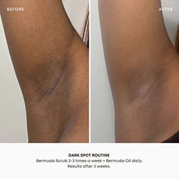 Bushbalm Dark Spots & Ingrown Hair Routine - 2 Steps