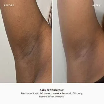 Bushbalm Dark Spots & Ingrown Hair Routine - 2 Steps