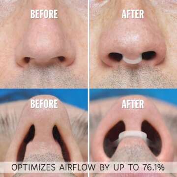 AIRMAX Nasal Dilator for Better Sleep and Breathing