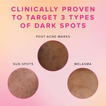 Farmacy 3% TXA Toner for Face - Brightening Face Toner for Oily Skin - Liquid Exfoliant with Azelaic Acid + 5% PHA to Target Visible Dullness + Help Reduce Uneven Skin Tone (120ml)