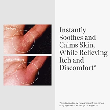 Murad Eczema Control Quick Relief Cream for Sensitive Skin