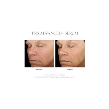 SkinMedica TNS Advanced+ Serum for Radiant Skin