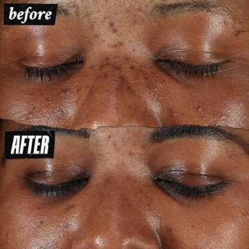 Kiehl's Clearly Corrective Dark Spot Serum for Bright Skin