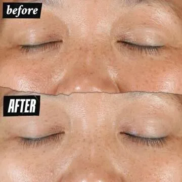 Kiehl's Clearly Corrective Dark Spot Serum for Bright Skin