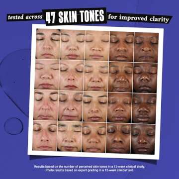 Kiehl's Clearly Corrective Dark Spot Serum for Bright Skin