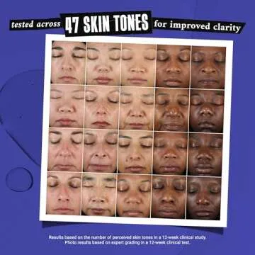 Kiehl's Clearly Corrective Dark Spot Serum for Bright Skin