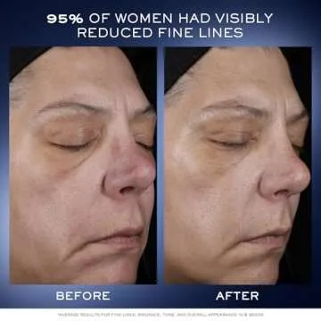 Lancôme Génifique Serum for Youthful Skin - 1 Fl Oz