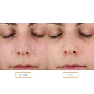 Clarisonic Sonic Face Exfoliator Brush Head for Radiant Skin