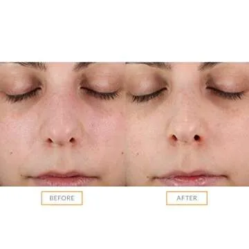 Clarisonic Sonic Face Exfoliator Brush Head for Radiant Skin