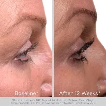 Obagi Eyelash Enhancing Serum for Lush Length and Thickness