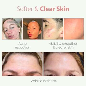 TALLOWRX 100% Organic 4 OZ Whipped Beef Tallow and Honey Balm Tallow and Honey Balm - Beef Tallow for Face - Tallow and Honey Balm For Face - Beef Tallow Skin Care - VANILLA SCENTED