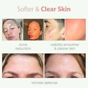 TALLOWRX 100% Organic 4 OZ Whipped Beef Tallow and Honey Balm Tallow and Honey Balm - Beef Tallow for Face - Tallow and Honey Balm For Face - Beef Tallow Skin Care - VANILLA SCENTED