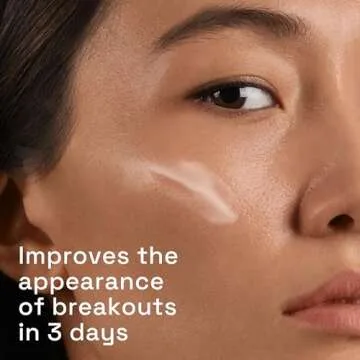 Cetaphil Gentle Clear Acne Treatment Serum 1oz – Fast Results