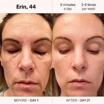 Solawave 4-in-1 Facial Wand | Red Light Therapy for Face and Neck | Microcurrent Facial Device for Anti-Aging | Skin Tightening Machine | Face Massager | Facial Wand (Rose Gold)