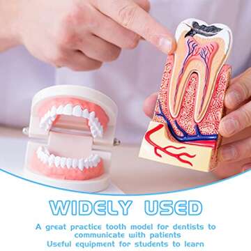 Nuanchu 4 Pcs Dental Teeth Model Standard Teeth Models Plastic Mouth Model Bulk Teaching Study Supplies for Teaching Dentist Dental Clean Display, 3.15 x 2.2 in