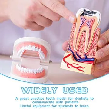 Nuanchu 4 Pcs Dental Teeth Model Standard Teeth Models Plastic Mouth Model Bulk Teaching Study Supplies for Teaching Dentist Dental Clean Display, 3.15 x 2.2 in