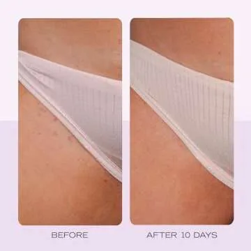 First Aid Beauty - Ingrown Hair Pads with BHA + AHA - Aftershave Treatment Pads to Help Prevent Razor Bumps for Men & Women - Exfoliate Underarms & Bikini Area - Compostable for Daily Use - 60 Pads