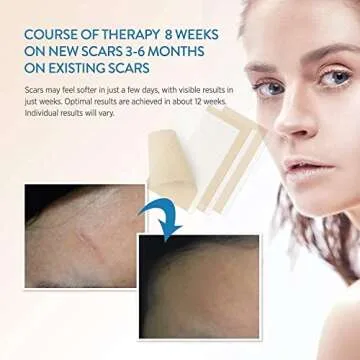 Aroamas Scar Silicone Sheets - Flattens Scars Effectively