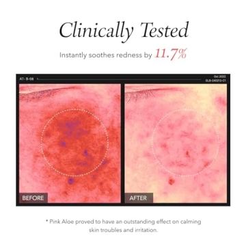 APRILSKIN Pink Aloe Cleanser | Gentle Exfoliation & Makeup Remover