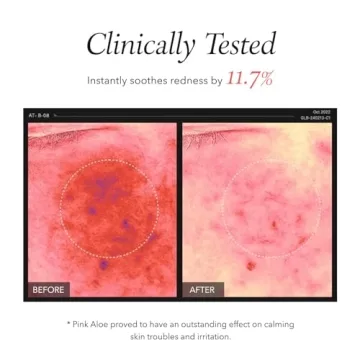 APRILSKIN Pink Aloe Cleanser | Gentle Exfoliation & Makeup Remover