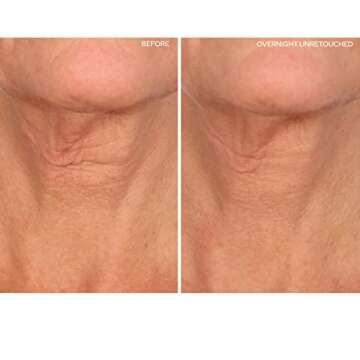 SiO Beauty NeckLift - Neckline Anti-Wrinkle Patch - Overnight Smoothing Silicone Patches For Neck Wr...