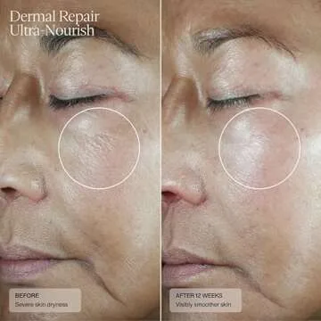 Sente Dermal Repair Cream - Nourishing Rosacea Solution