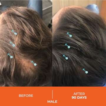 DS Laboratories Revita Shampoo and Conditioner Set - Hair Growth Shampoo and Conditioner, Hair Thickening Shampoo and Conditioner for Fine Hair, DHT Blocker Hair Loss Treatments for Women & Men