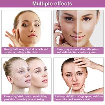 Diamond Microdermabrasion Machine, Yofuly 65-68cmHg Suction Power Professional Dermabrasion, Home Use Facial Skin Care Equipment