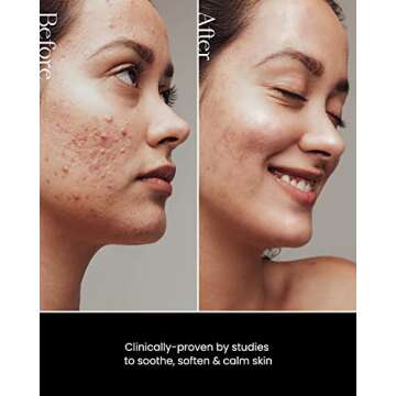 SON&PARK Beauty Water 340ml (11.49 fl. oz) | Multi-Purpose Toner for Oil Control Hydrating Exfoliating Skincare Daily Cleansing Booster with Rose Water Witch Hazel Lavender Oil