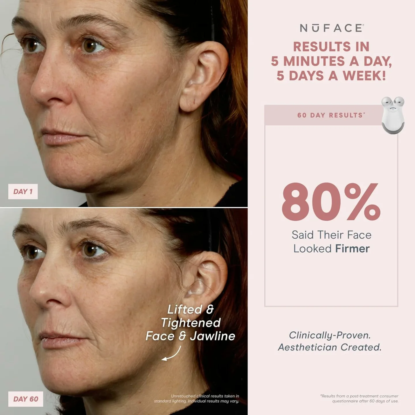 NuFACE Mini & FIX Starter Kit for Toning & Smoothing